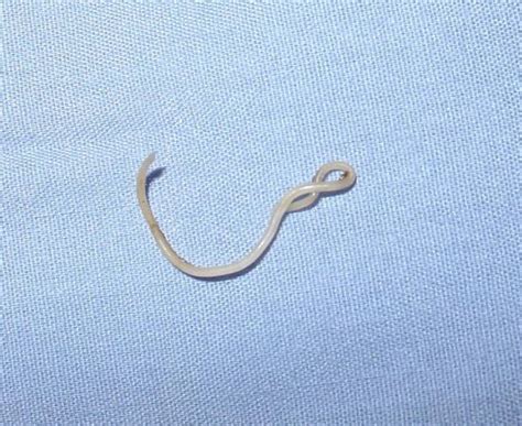 Difference Between Roundworm And Tapeworm Definition Body Structure