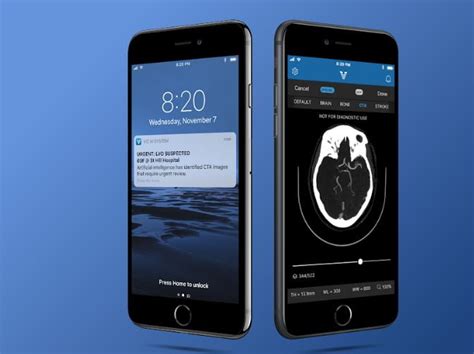 (windows 10) or windows cannot open this file (windows 7) or a similar mac/iphone/android alert. Viz.ai Raises $50M To Detect Ischemic Stroke Using AI ...