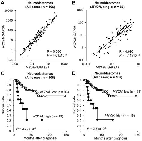 Ncym Expression Is Associated With Poor Prognosis In Human