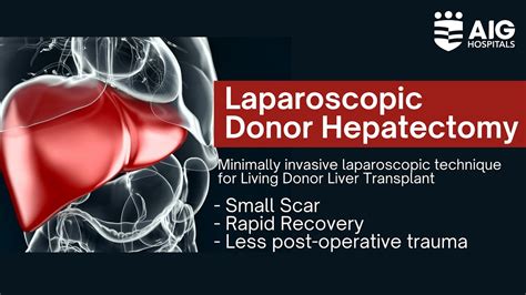 Laparoscopic Donor Hepatectomy Minimally Invasive Liver Transplant