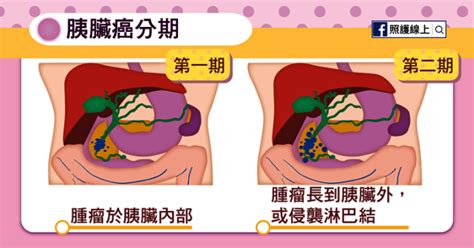 Aug 27, 2018 · 名嘴「許願折壽」給腦癌尪 2個月後胸部發現硬塊、焚垃圾毒氣致癌 美軍駐阿富汗20年.病死比戰死多、12歲就發願要當總統 拜登窮盡一生終登大位 胰臟癌最完整介紹/胰臟癌又帶走一位名人!5族群需特別提防 元氣網 - paulhsu333 的部落格 - udn部落格