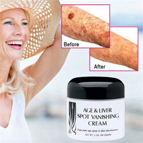 Age And Liver Spot Fade Vanishing Cream Non Greasy For Uneven Skin Tone