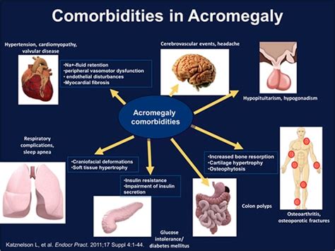 acromegaly diagnosis and management options transcript