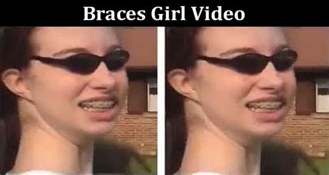 [full Video] Braces Girl Video Check The Content On Braces Girl Full Video Viral On Reddit
