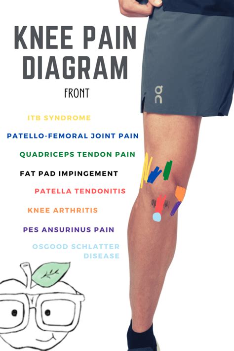 The Cause Of Knee Pain Why Its A Consequence Of Something Else Your