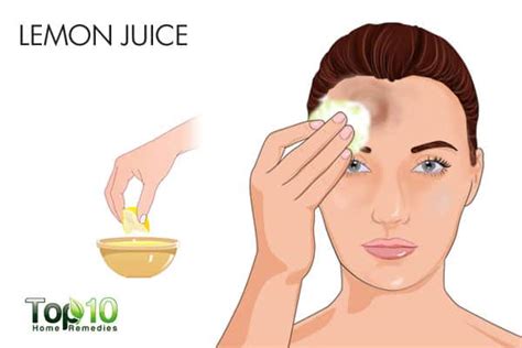 How To Get Rid Of Bumps On Forehead Top 10 Home Remedies