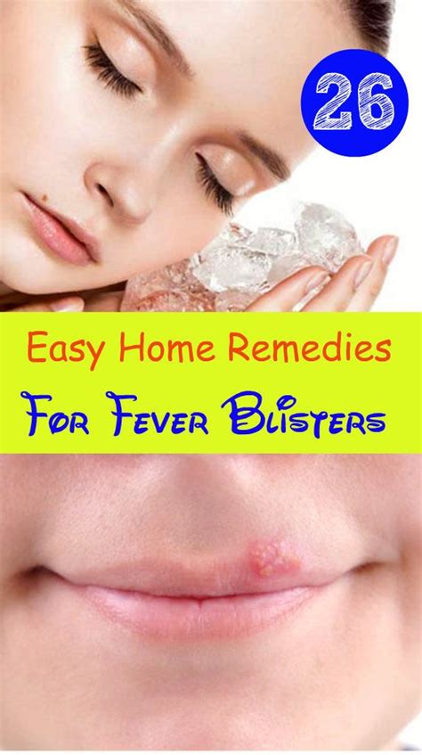 26 Easy Home Remedies For Fever Blisters Home Remedies For Fever