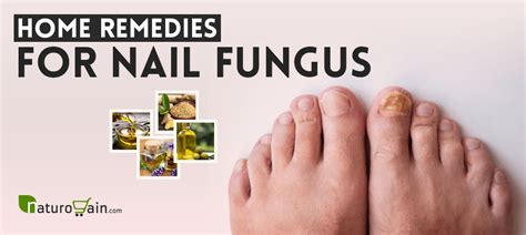 6 Superb Home Remedies For Nail Fungus Get Rid Of Toenail Onychomycosis