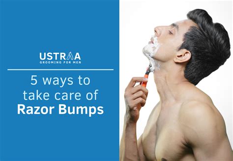 5 Ways To Treat And Prevent Razor Burn Mens Shaving Tips Ustraa