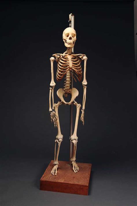 Fine Antique Real Human Skeleton