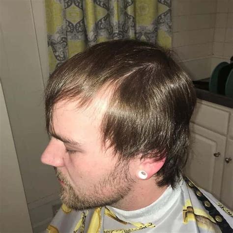 84 Things About Hairstyle For Balding Crown Male Subkhanov