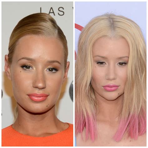 Iggy Azalea Opens Up About Her Nose Job I M Not Denying It