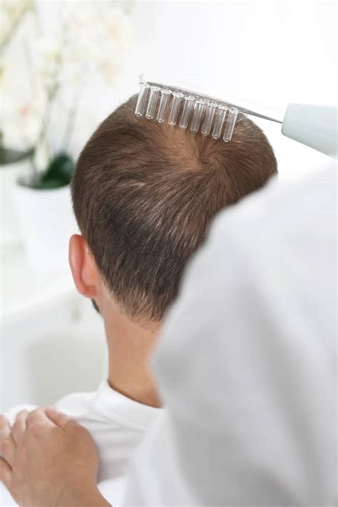 Modern Hair Loss Solutions Az Hair Restoration Hair Loss