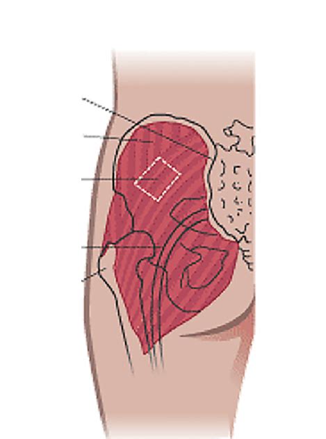 Dorsogluteal Injection Site