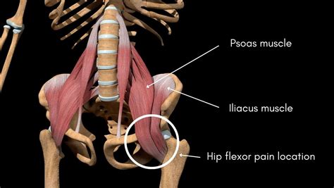 Hip Flexor Pain Anatomy Causes And Treatment