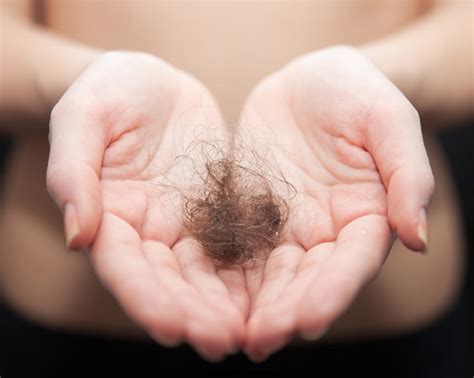 Consider that most people have over a hundred thousand hairs on their head, the loss of even a hundred hairs a day isn't noticeable. How Much Everyday Hair Loss Is Normal? | HuffPost