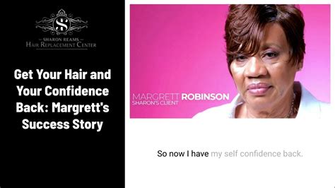 from hair loss to hair gain margrett r shares on hair replacement hair replacement center