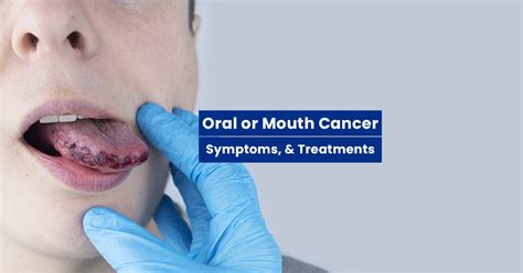 Understanding Oral Mouth Or Tongue Cancer Signs Treatments