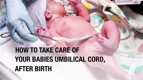 How To Take Care Of Your Babies Umbilical Cord After Birth Youtube