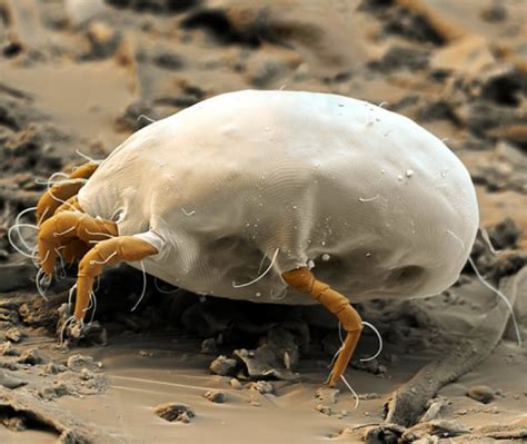 A Dust Mite As Seen Through A Scanning Electron Microscope Sem R
