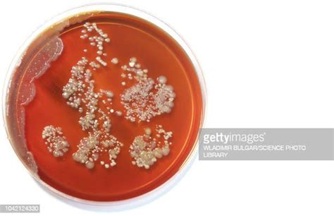 Bacteria Agar Photos And Premium High Res Pictures Getty Images