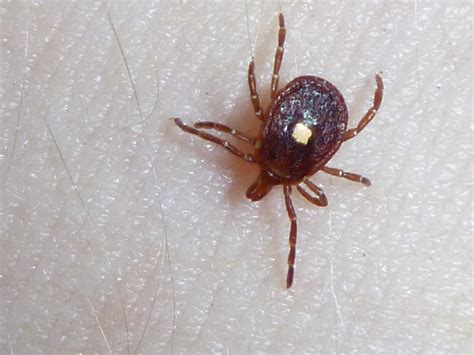 Bite From Lone Star Ticks Can Cause Acquired Red Meat Allergy Symptoms