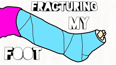 Fracturing My Foot Youtube