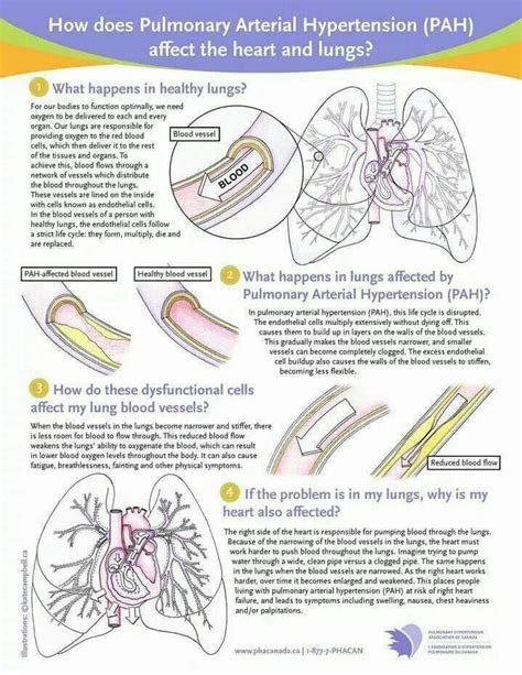The Heart And Lungs Scienceaid
