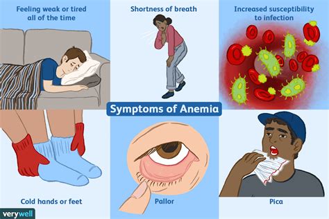 Sickle Cell Anemia Cartoon
