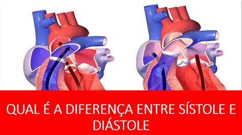 Qual É A DiferenÇa Entre PressÃo Arterial SÍstolica E DiastÓlica