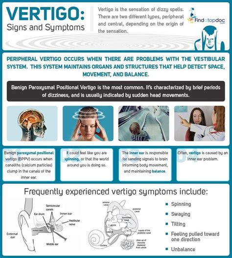 Vertigo Causes Symptoms And Treatment