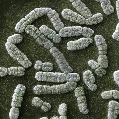 Human Chromosomes Sem Photograph By Power And Syred