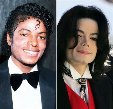 New Michael Jackson Plastic Surgery Details