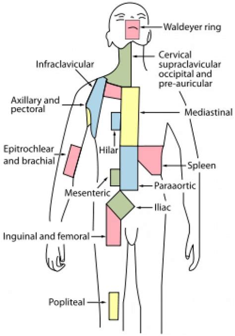 Virchows Node Or Signal Node Is A Lymph Node In The Left