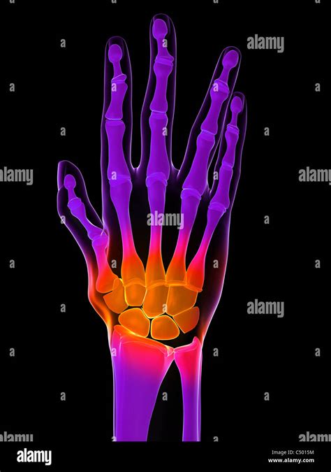 Inflammation Finger High Resolution Stock Photography And Images Alamy