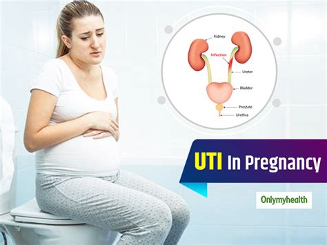Urinary Tract Infection In Pregnancy Know Causes Symptoms And