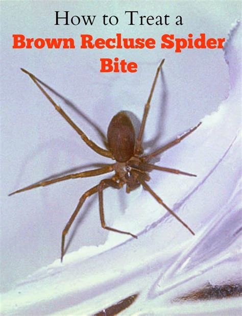 How To Treat A Brown Recluse Spider Bite After Teotwa Vrogue Co