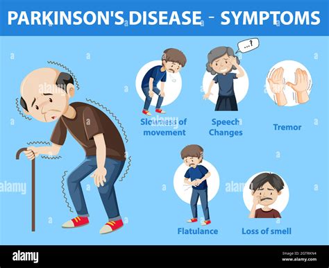 Infografía De Los Síntomas De La Enfermedad De Parkinson Imagen Vector De Stock Alamy