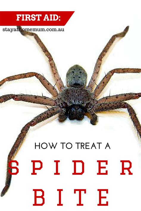 The bite feels like a pinprick, so you may not notice it. First Aid: How To Treat A Spider Bite - Stay at Home Mum