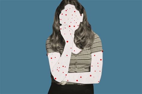 Tessa Miller Book Excerpt A Case Of Adult Chickenpox Landed Me In The