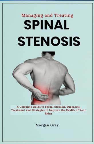 Managing And Treating Spinal Stenosis A Complete Guide To Spinal