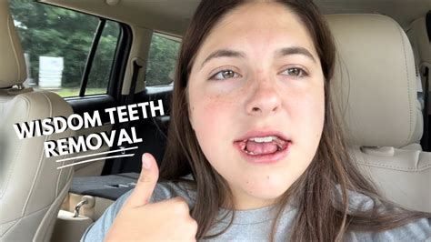 I Got All Of My Wisdom Teeth Removed Vlog Youtube