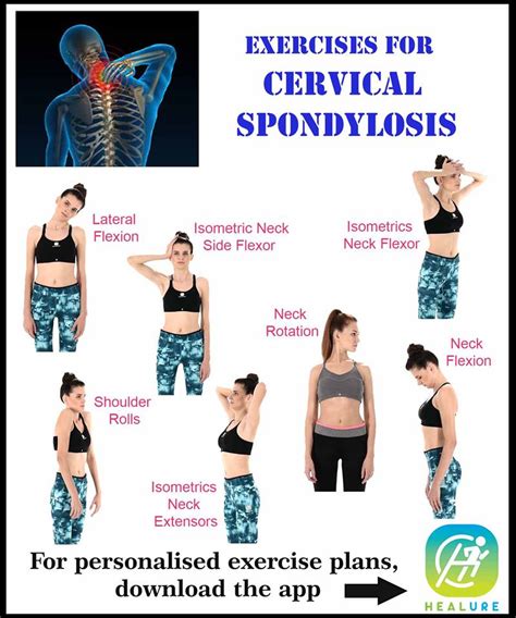 Healure On Twitter Exercises For Cervical Spondylosis For More