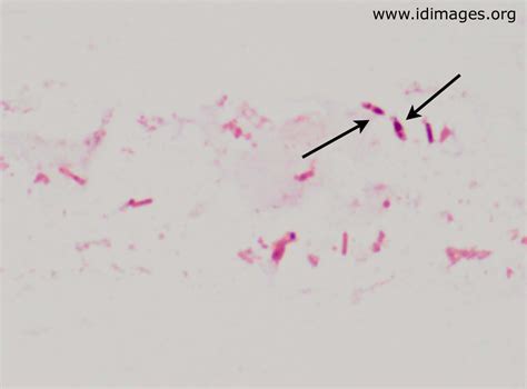 Campylobacter, clostridium difficile, clostridium perfringens och salmonella. Clostridium symbiosum