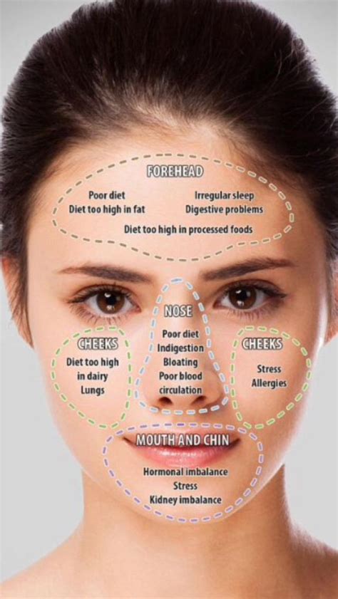 Acne Skin Chart Joyoendo