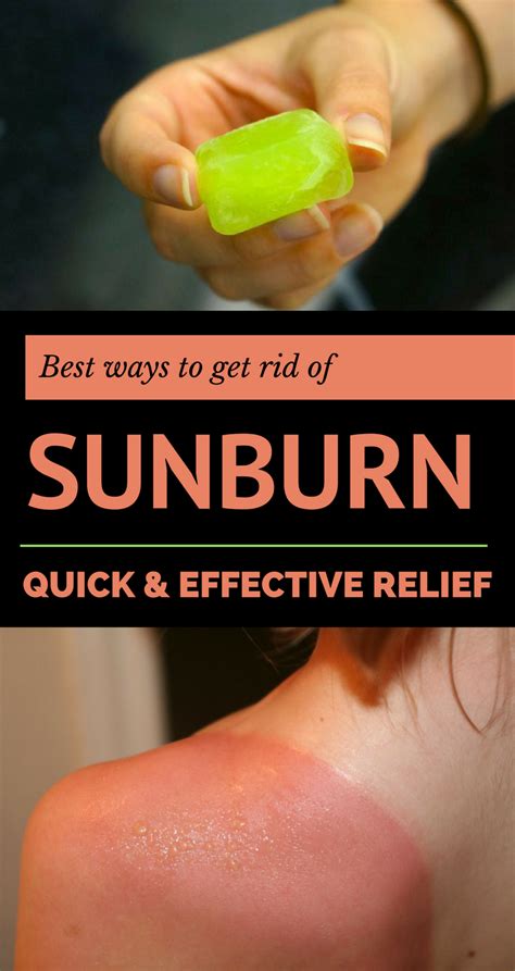 Best Ways To Get Rid Of Sunburn Quick And Effective Relief In 2020
