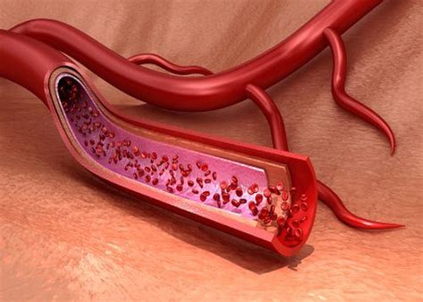 How To Improve The Health Of Your Blood Vessels