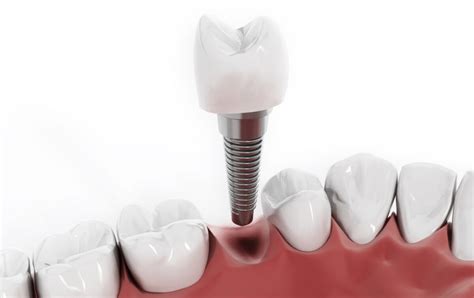 Simple Science: How to Make a Volcano with Kids
