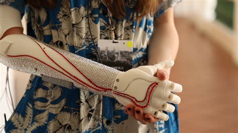 Open Bionics Uk Startup Creates Custom Fitted 3d Printed Bionic Arm For Less Than £1000