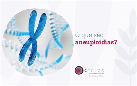 As Principais Aneuploidias São: